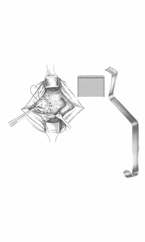 Aorta Retractors